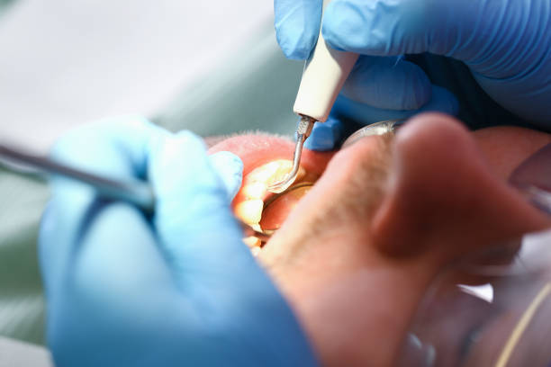 Best Pediatric Emergency Dentist in Center Point, IA