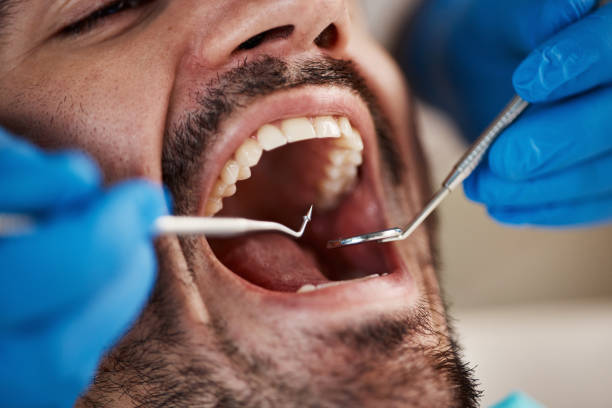 Best Urgent Care for Lost Fillings or Crowns in Center Point, IA