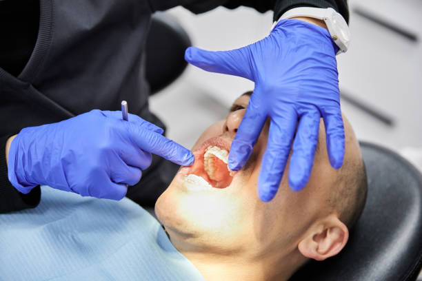 Best Emergency Dental Care for Broken or Chipped Teeth in Center Point, IA