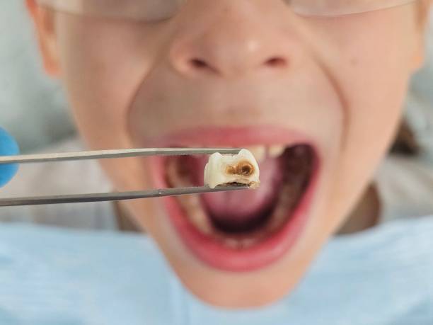 Best Emergency Denture Repair in Center Point, IA