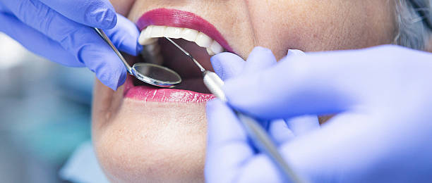 Best Emergency Gum Treatment in Center Point, IA